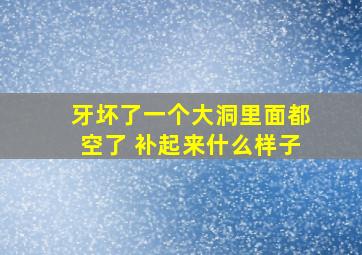 牙坏了一个大洞里面都空了 补起来什么样子